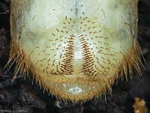 Hairs at the posterior end of the worm