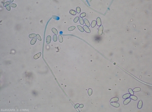 Appearance under a light microscope of conidiophores and conidia of <i> <b> Trichothecium roseum </b> </i>.  (pink mold)