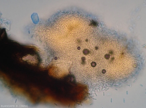 Appearance of an acervule in section on which we can distinguish the many conidia formed remaining agglomerated in mass.  <i> <b> Colletotrichum </i> sp </b>.  (ripe rot)