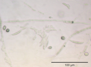 Fusarium_oxysporum_fs_p_melongenae17