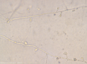 Appearance of microconidia of <b><i> Fusarium oxysporum </i> f.  sp.  <i> melongenae </i></b> clustered in a false head at the end of short monophialid conidiophores. 