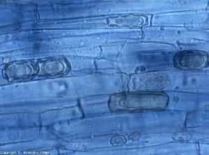 Chlamydospores (or cysts or resting spores) of <b> <i> Olpidium brassicae </i> </b>, star-shaped due to folds in the inner wall, are visible in several cells of the cortex .