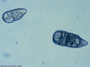 The conidia are muriform, very brown when mature, rounded at one end and pointed at the other.  Their average dimensions are of the order of 48 x 22 µm.  <b> <i> Stemphylium solani </i> </b> (stemphyliosis, gray leaf spot)