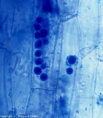 Zoosporangia in place in some cells of the cortex.  <i> <b> Spongospora subterranea </b> </i> (<i> Spongospora, Spongospora </i> root tumor)