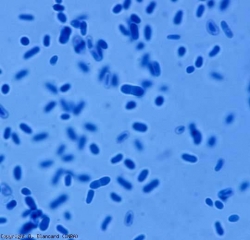 The pycnospores are smooth and hyaline, oblong to ellipsoid, even obovoid, uni or bicellular.  Their dimensions vary from one conidium to another (3-11 x 2-4.5 µm).  <b> <i> Didymella lycopersici </i> </b> (<i> Didymella </i> canker, <i> Didymella </i> stem canker and fruit rot)