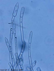 The white down is in fact made up of the numerous septate and more or less slender conidiophores of the fungus.  At their end, conidia are formed.  Note that the terminal conidia is characteristic because it presents a pointed apex, called <i> spearhead </i>.  <b> <i> Leveillula taurica </i> </b> (powdery mildew)