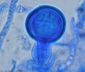 Appearance of a fertilized oogonium of <i> <b> Phytophthora infestans </b> </i> (downy mildew).