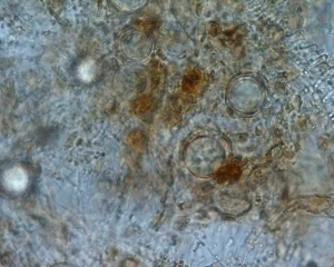 Several <i> <b> Phytophthora infestans </b> </i> (late blight) oospores are visible in the leaf blade of a diseased leaflet.