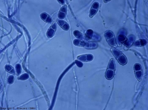 Several conidiophores still bear a few hyaline conidia, the older ones have detached.  Most of them are elongated with pyriforms and bicellular.  <b> <i> Trichothecium roseum </i> </b> (fruit rots)
