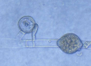 Smooth oogonium fertilized by an antheridium, intercalary hyphal swelling. <b> <i> Pythium </i> sp. </b> ("damping-off")