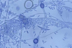 <b> <i> Fusarium oxysporum </i> f.  sp.  <i>lactucae</i> </b> ("fusarium wilt") produces unicellular microconidia and "crescent" shaped macroconidia with a maximum of 3 to 4 septa.  It also forms thick-walled, intercalated or terminal chlamydospores and isolated or in chains.