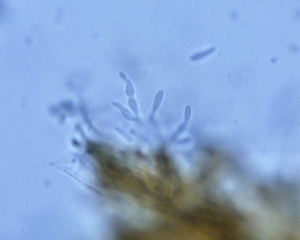 The conidiophores observable in the acervuli are smooth and hyaline, sometimes septate;  they show a narrowing in the conidiogenic region.  <b> <i> Microdochium panattonianum </i> </b> (anthracnose, "shot-hole")