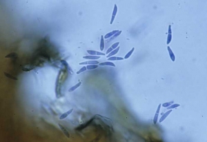 Numerous spindle-shaped and hyaline conidia are produced at the end of the conidiophores.  They are usually bicellular when mature, slightly curved and show constriction at the septum.  The length varies from 5 to 17 µm.  <b> <i> Microdochium panattonianum </i> </b> (anthracnose, "shot-hole")