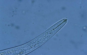The stylet of this adult nematode is particularly visible.  <b> <i> Paratylenchus </i> sp. </b> ("lesion nematodes")