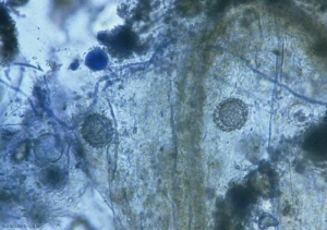 Observation under a photonic microscope often makes it possible to observe the presence of structures characteristic of <i> Pythium </i>: mycelium, oogonia (ornamented in this case), sporangia.  <b> <i> Pythium </i> sp. </b> ("damping-off")