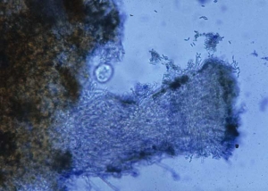 The sporodochia of <b> <i> Myrothecium roridum </i> </b> consist of numerous cylindrical and hyaline conidiophores, branched, bearing phialides.