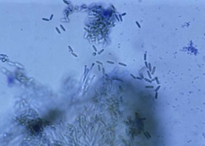 The phialides form cylindrical conidia, rounded at their ends, hyaline to slightly olive.  <b> <i> Myrothecium roridum </i> </b>