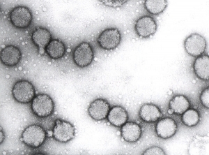 Spherical virus particles 85 nm in diameter.  The presence of a lipid envelope gives them a particular appearance.  <b> Tomato spotted wilt virus </b> (<i> Tomato spotted wilt virus </i>, TSWV)