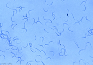 The Beta spores of <b> <i> Phomopsis viticola </i> </b> are long, thread-like and arching.