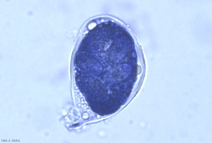 An ascus of <b> <i> Erysiphe necator </i> </b> can contain 2 to 8 ascospores.