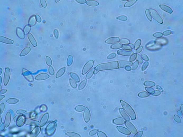 Los conidios de <i> <b> Cladosporium cucumerinum </b> </i> son oblongos, fusiformes, asépticos, rara vez de 1 a 2 septados;  luego miden 4,6-5,7 x 16,4-22,5 µm.  (cladosporiosis)