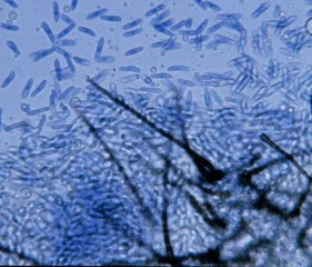 Aparición de conidios producidos por acérvulos de <i> <b> Colletotrichum orbiculare </b> </i> (nube roja o antracnosis)