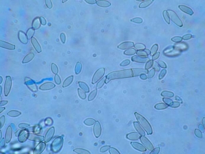 Los conidios de <i> <b> Cladosporium cucumerinum </b> </i> son oblongos, fusiformes, asépticos, rara vez de 1 a 2 septados;  luego miden 4,6-5,7 x 16,4-22,5 µm.  (cladosporiosis)