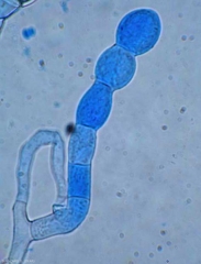 Se formaron tres conidios de cadena corta al final de un conidióforo corto de <i> <b> Podosphaera xanthii </b> </i>.  (Oidio)