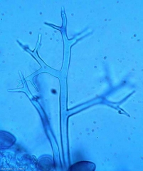 Detalle de un esporangióforo arbustivo de mildiú velloso observado al microscopio óptico. <i> <b> Pseudoperonospora cubensis </b> </i> (mildiú velloso)