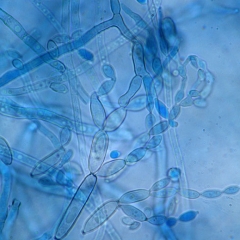 Disposición de conidios en un conidióforo de <i> <b> Cladosporium cucumerinum </b> </i> (cladosporiosis) 