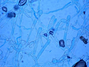 Se erigen varios conidióforos en el micelio.  Se han formado uno o unos pocos conidios en sus extremos.  <i> <b> Podosphaera xanthi </b> </i> o <b> <i> Golovinomyces cichoracearum </i> var.  <i> cichoracearum </i> </b> (Oidio).