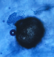 Aspecto de picnidios maduros, los conidios son extruidos por el ostiolo.  <b> <i> Phoma cucurbitacearum </i> </b> (forma anamórfica)