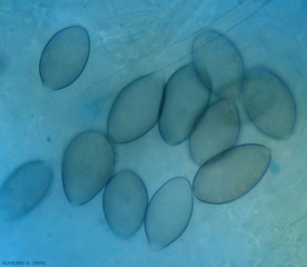 En esta lámina se observan varios esporangios más o menos melanizados al microscopio óptico.  <i> <b> Pseudoperonospora cubensis </b> </i> (mildiú ).