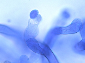 Los basidios (12-18 x 8-11) rara vez se forman en el micelio, coronados por 3 a 7 esterigmas.  Las basidiosporas son asimétricas y miden 7-11 x 4-7 µm.  <i> <b> Thanatephorus cucumeris </b> </i> (<i> Rhizoctonia solani </i>)