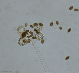 La observación al microscopio óptico permite distinguir las vesículas primarias y secundarias que constituyen en parte el esporociste.  <i> <b> Choanephora cucurbitarum </b> </i>.