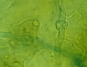 Se forman algunos haustorios en estos filamentos miceliales de <b> <i> Oidium neolycopersici </i> </b> (mildiú polvoroso, moho blanco) </b>