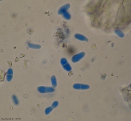 Las picniosporas pueden tener o no una partición. Sus dimensiones varían de una conidia a otra (3-11 x 2-4,5 µm). <b> <i> Didymella lycopersici </i> </b> (Cancro de Didymella, Cancro del tallo de Didymella y pudrición de la fruta)