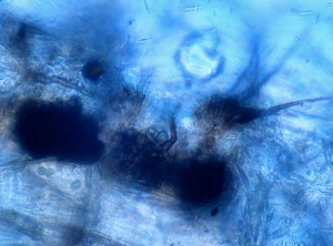 Las cerdas o pelusas son visibles en estos microesclerocios de <b> <i> Colletotrichum coccodes </i> </b>.