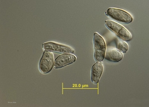 Detalle de los conidios bicelulares más característicos de la forma asexual de <b> <i> Passalora fulva </i> </b> (cladosporiosis, moho foliar) (Bruce WATT - Universidad de Maine)