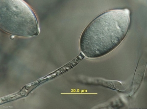 Detalle de un esporangio joven formado al final de un esporangióforo. <b> <i> Phytophthora infestans </i> </b> (mildiú velloso) (Bruce WATT - Universidad de Maine)