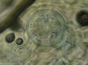 Detalle de una oospora <i> Plasmopara viticola </i> joven de paredes gruesas, observada al microscopio óptico.