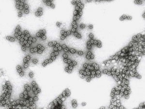 Partículas de virus isométricas de aproximadamente 29 nm de diámetro.  <b> Virus del mosaico del pepino </b> (<i> Virus del mosaico del pepino </i>, CMV)