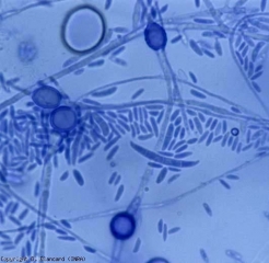 <b> <i> Fusarium oxysporum </i> f.  sp.  <i> lycopersici </i> </b> produce microconidios unicelulares y macroconidios en forma de media luna con un máximo de 3 a 4 septos.  También forma clamidosporas de paredes gruesas, intercelulares o terminales y aisladas o en cadenas.  <b> Marchitez por Fusarium (<i> Fusarium </i> marchitez) </b>