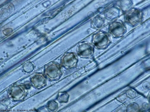 Se han desarrollado esporas estrelladas en reposo de <b> <i> Olpidium brassicae </i> </b> en varias células de la corteza.
