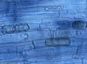 Las clamidosporas (o quistes o esporas en reposo) de <b> <i> Olpidium brassicae </i> </b>, en forma de estrella debido a pliegues en la pared interna, son visibles en varias células de la corteza.