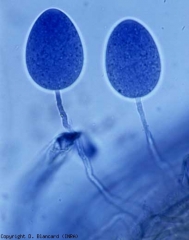 Se formaron dos esporangios de <i> Phytophthora cryptogea </i> en el exterior de esta raíz de tomate necrótica y podrida, extraídos de un cultivo sin suelo.  Por lo general, los esporangios de <i> Phytophthora </i> spp.  se forman más fácilmente en los tejidos.  <b> <i> Phytophthora </i> spp.  </b> (podredumbre de raíces y basales, podredumbre de patas y raíces, podredumbre de castaño de Indias)