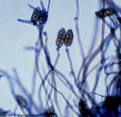 Podemos distinguir algunos conidios pardos y puntiagudos en medio de conidióforos pardos y divididos (130-200 x 4-7 µm).  <b> <i> Stemphylium solani </i> </b> (stemphyliosis, mancha gris de la hoja)