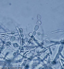 Se pueden ver estructuras en forma de barril en el micelio;  se consideran esclerocios en blanco.  <b> <i> Thanatephorus cucumeris, Rhizoctonia solani </i> </b>