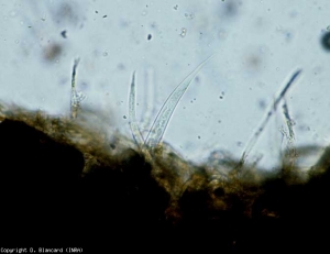 Varios nematodos han penetrado más o menos profundamente en la corteza de esta raíz de tomate.  <b> <i> Pratylenchus </i> spp. </b> (nematodos de la pudrición de la raíz, lesiones por nematodos)