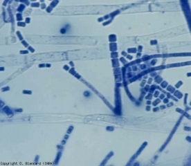 Varios conidióforos de <b> <i> Geotrichum candidum </i> </b> forman conidios cilíndricos en cadena.